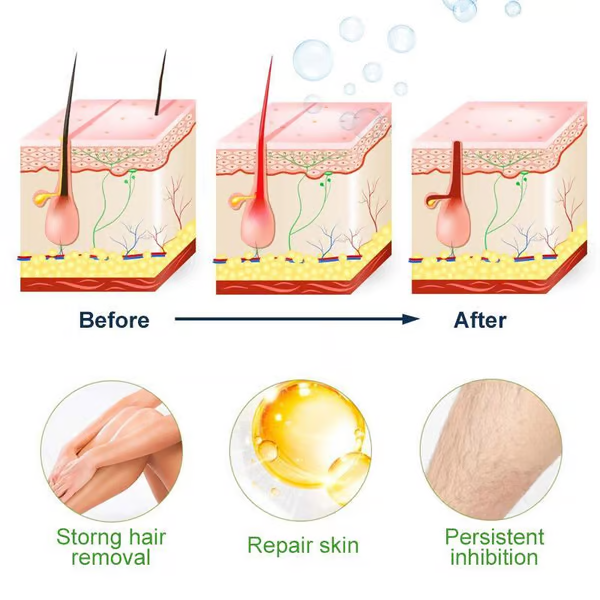 【Buy 1 Get 2 Free】SEMI-PERMANENT HAIR REMOVAL SPRAY