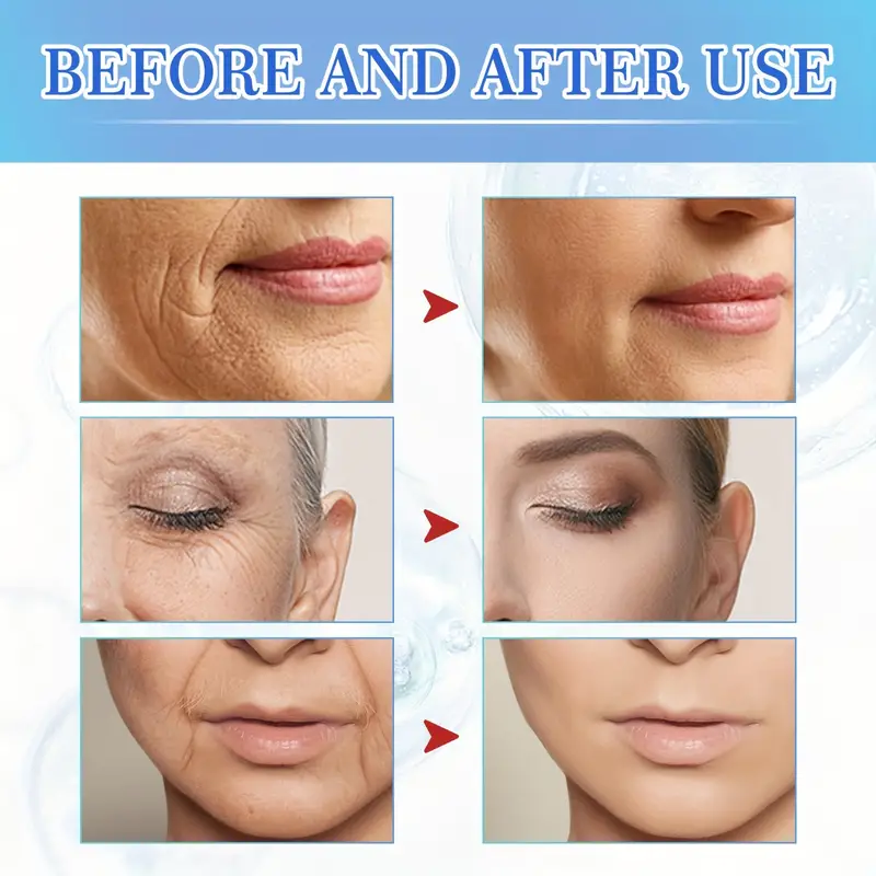 【Buy 1 Get 2 Free】Intensive Anti Aging Botox Facial Serum - Plumps, Firms, And Smooths Fine Lines And Wrinkles For All Skin Types